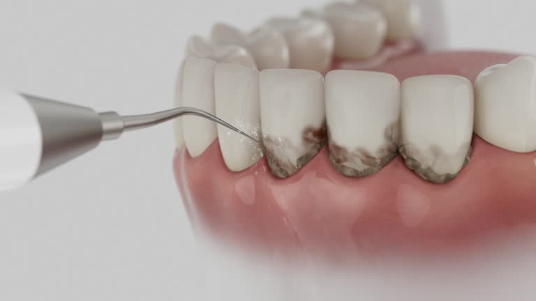 Reliable Teeth Whitening contractor in McHenry County County, ND by Dentist Open Now